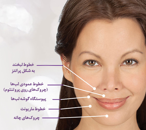 چگونه خطوط لبخند را بپوشانیم؟